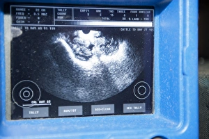 Lamb Prints: Sheep farming, ultrasound scanner screen