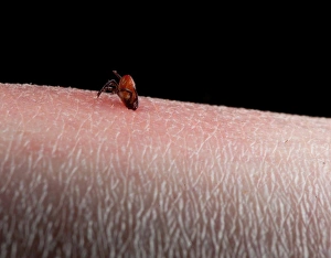 Blood Prints: Tick (Acarina sp. ) adult, feeding, on human skin with inflammation, England, june